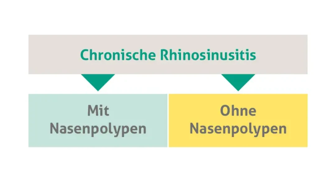 Einfaches Diagramm zur Klassifizierung der chronischen Rhinosinusitis. Oben steht der Haupttitel "Chronische Rhinosinusitis", darunter befinden sich zwei Kästchen: links ein hellgrünes mit der Beschriftung "Mit Nasenpolypen" und rechts ein gelbes mit der Beschriftung "Ohne Nasenpolypen".