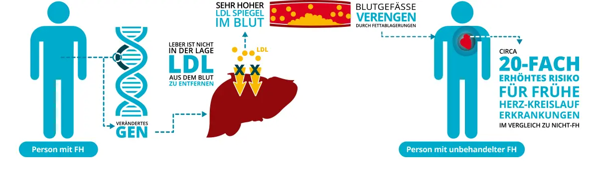 Abbildung zur Darstellung der Auswirkung von Familiärer Hypercholesterinämie (FH), von links nach rechts: Links steht eine FH-betroffene Person, wodurch die Leber LDL nicht aus dem Blut entfernen kann, was zu hohen LDL- Spiegeln führt. Dies führt zur mittleren Abbildung, hier sind verengte Blutgefäße durch Fettablagerungen dargestellt. Dies führt weiter zur rechten Abbildung, wo eine FH-betroffene Person und es wird gezeigt, dass eine unbehandelte FH ein 20-fach erhöhtes Risiko für frühe Herz-Kreislauf-Erkrankungen im Vergleich zu Nicht-FH- Personen mit sich bringt.