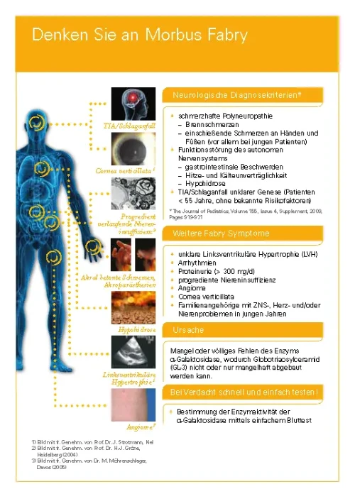 Medizinisches Informationsblatt mit dem Titel 'Denken Sie an Morbus Fabry' mit Auflistung neurologischer Diagnosekriterien und Symptome wie schmerzhafte Neuropathie, Brennschmerzen, Funktionsstörungen des autonomen Nervensystems und weiteren Fabry-Symptomen, die Herz und Nieren betreffen.