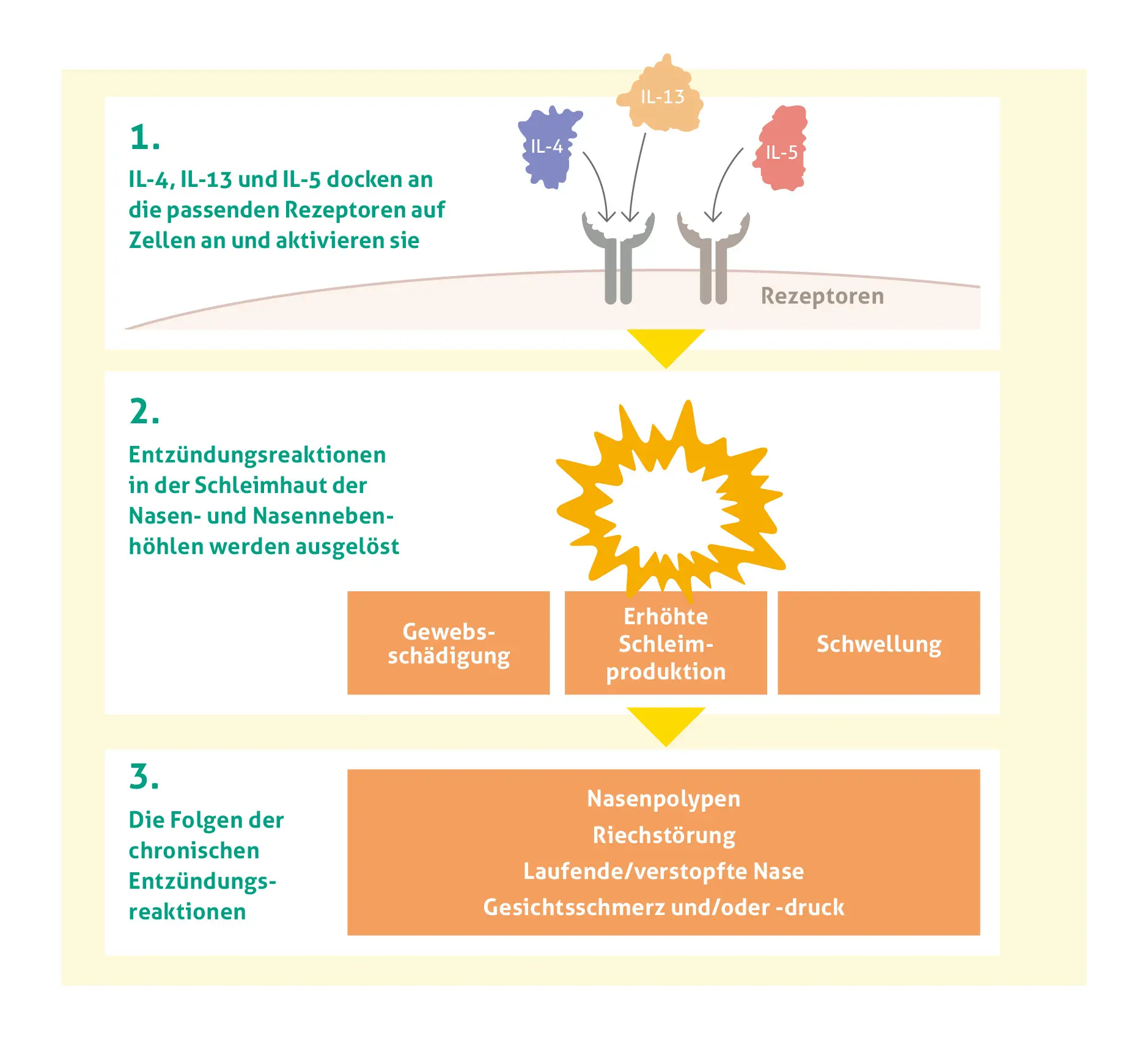 Infografik zum Entzündungsprozess bei chronischer Rhinosinusitis in drei Schritten: 1. IL-4, IL-13 und IL-5 docken an passende Rezeptoren auf Zellen an und aktivieren sie (dargestellt durch Zellen mit Rezeptoren). 2. Entzündungsreaktionen in der Schleimhaut der Nasen- und Nasennebenhöhlen werden ausgelöst, was zu Gewebsschädigung, erhöhter Schleimproduktion und Schwellung führt (symbolisiert durch eine Sonneneruption). 3. Die Folgen der chronischen Entzündungsreaktionen: Nasenpolypen, Riechstörung, laufende/verstopfte Nase sowie Gesichtsschmerz und/oder -druck (in einem orangefarbenen Rechteck zusammengefasst).